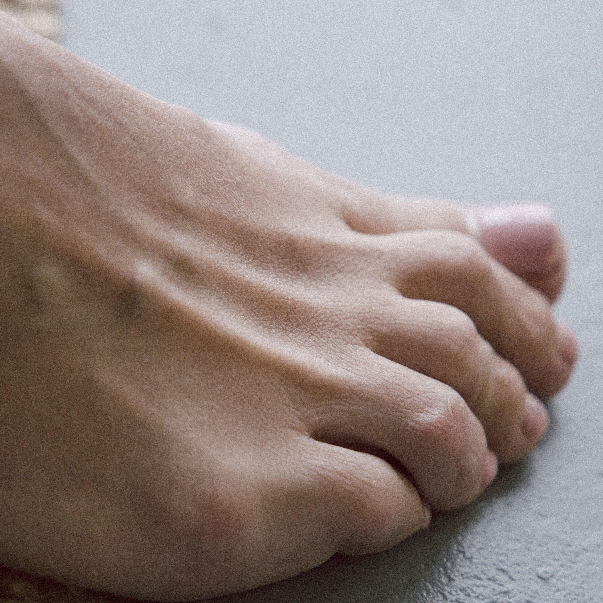 Todo sobre el Pie Plano