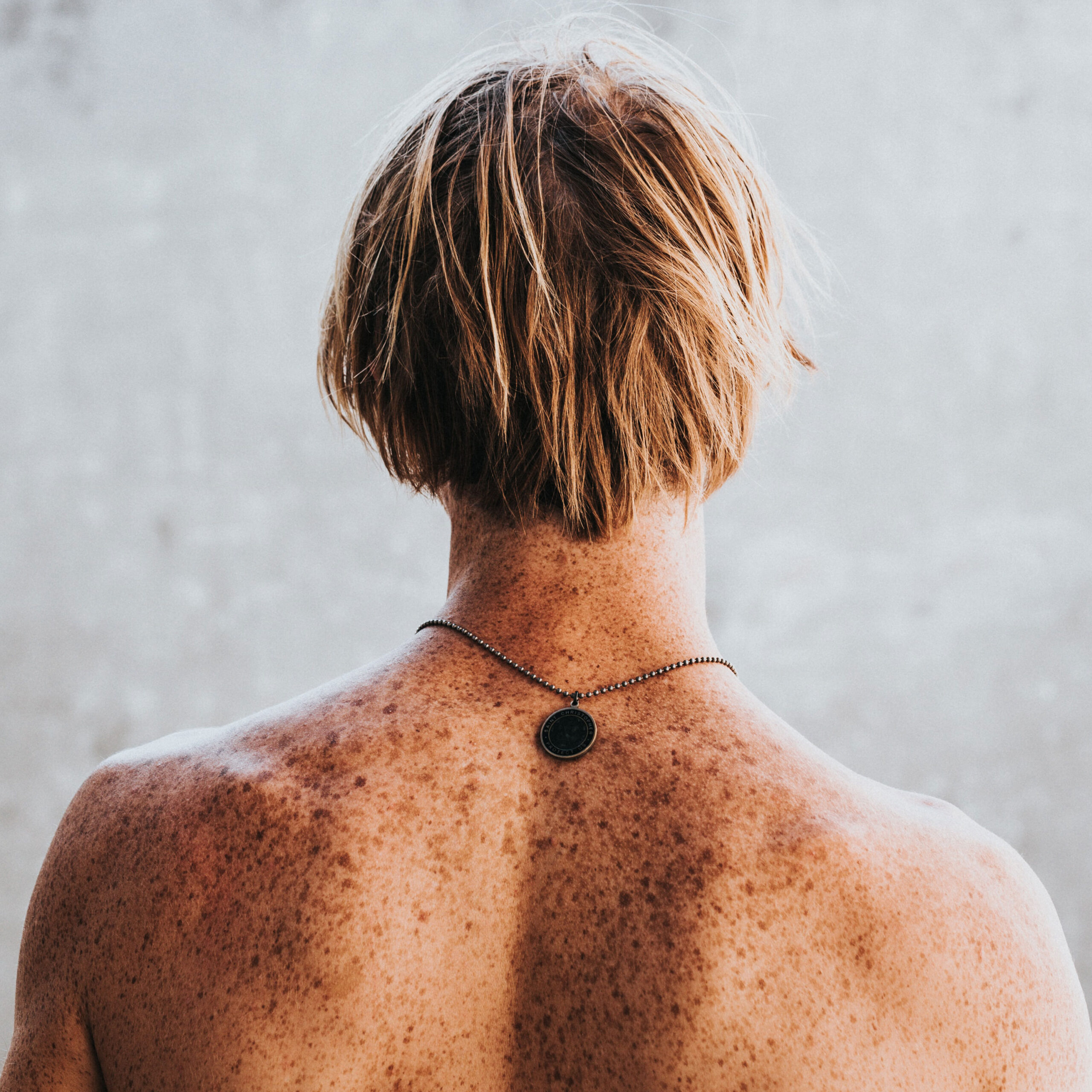 ¿Cómo atender las manchas en la piel?