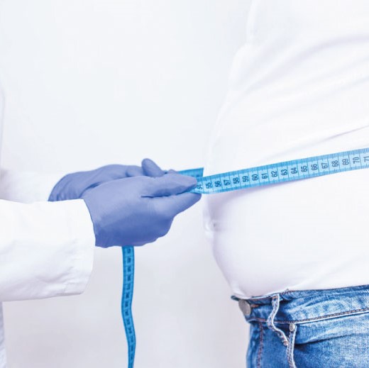 ¿Qué define la obesidad?