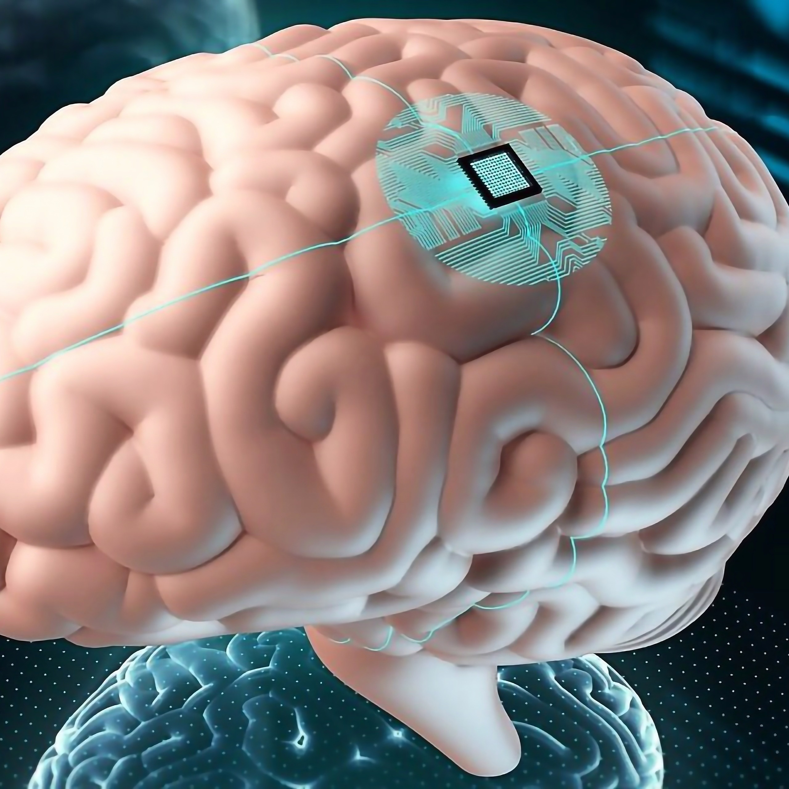Implantes cerebrales